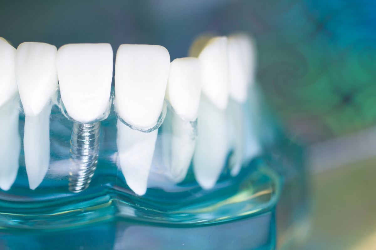 https://www.dentistadonadelli.it/wp-content/uploads/2025/03/6.png
