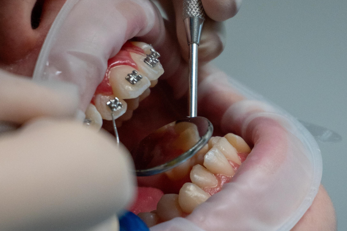 https://www.dentistadonadelli.it/wp-content/uploads/2025/04/servizi-ortodonzia.png